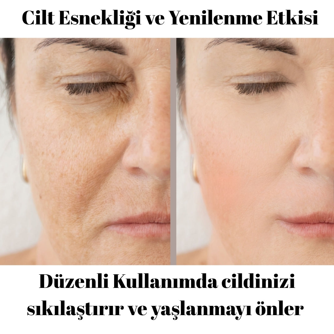 Rednar - Kırışıklık Giderici Doğal Botoks Kremi / Kuyruk Yağı & Vanilya Özlü 1 ALANA 1 BEDAVA