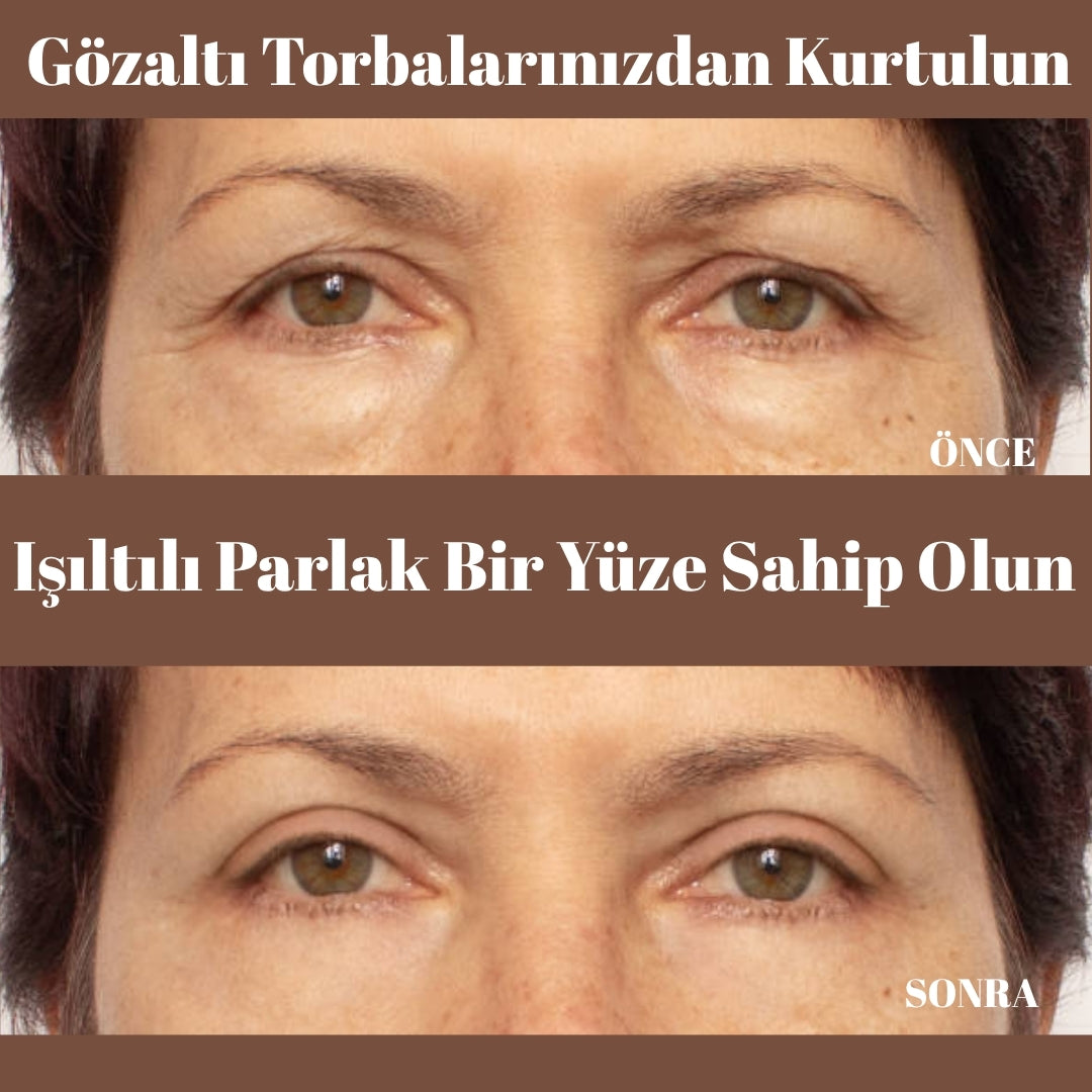 Rednar - Kırışıklık Giderici Doğal Botoks Kremi / Kuyruk Yağı & Vanilya Özlü 1 ALANA 1 BEDAVA