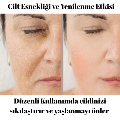 Rednar - Kırışıklık Giderici Doğal Botoks Kremi / Kuyruk Yağı & Vanilya Özlü 1 ALANA 1 BEDAVA